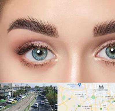 لیفت ابرو در جنوب تهران 