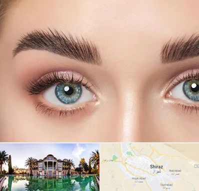 لیفت ابرو در شیراز