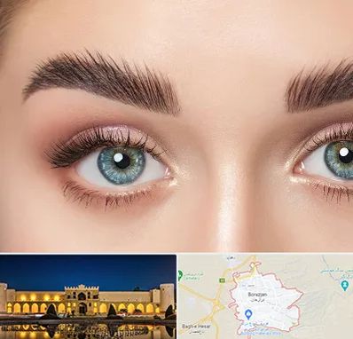 لیفت ابرو در برازجان