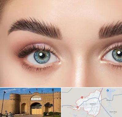 لیفت ابرو در ایرانشهر