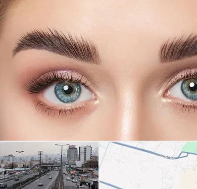 لیفت ابرو در بلوار ارتش