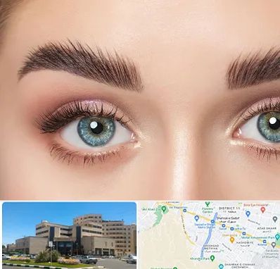 لیفت ابرو در صیاد شیرازی مشهد