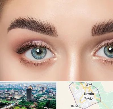 لیفت ابرو در ارومیه