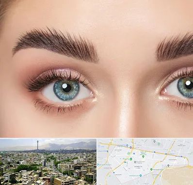 لیفت ابرو در منطقه 8 تهران