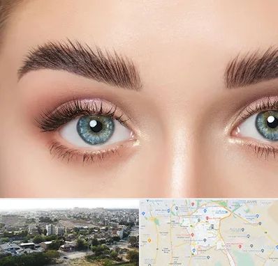 لیفت ابرو در منطقه 20 تهران