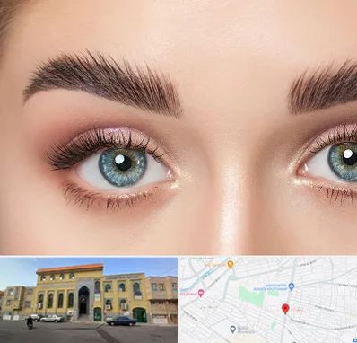 لیفت ابرو در زنبیل آباد قم