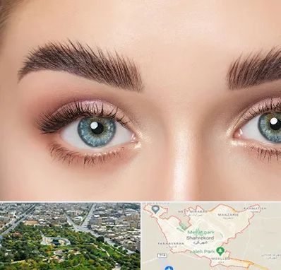 لیفت ابرو در شهرکرد