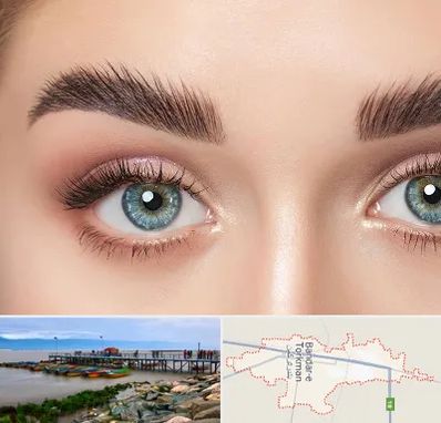 لیفت ابرو در بندر ترکمن