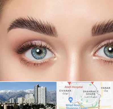 لیفت ابرو در شهرک غرب 