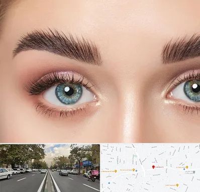 لیفت ابرو در دولت