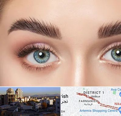 لیفت ابرو در فرمانیه 