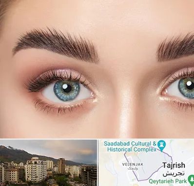 لیفت ابرو در زعفرانیه 