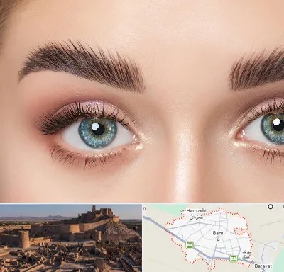 لیفت ابرو در بم