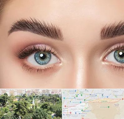 لیفت ابرو در منطقه 13 تهران