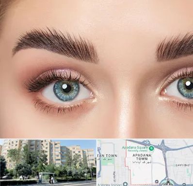 لیفت ابرو در آپادانا