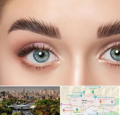 لیفت ابرو در منطقه 1 تهران