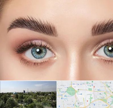 لیفت ابرو در منطقه 16 تهران