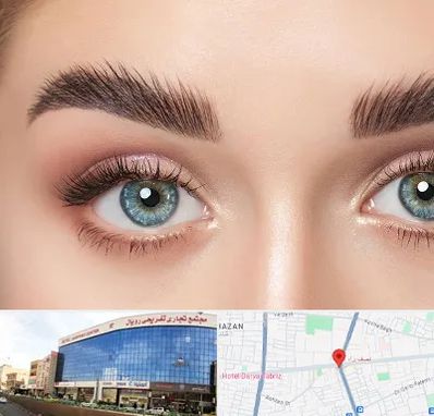 لیفت ابرو در نصف راه تبریز