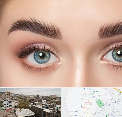 لیفت ابرو در شمیران نو