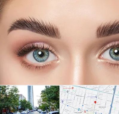 لیفت ابرو در امامت مشهد