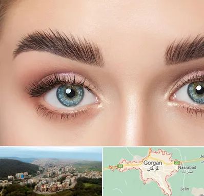 لیفت ابرو در گرگان