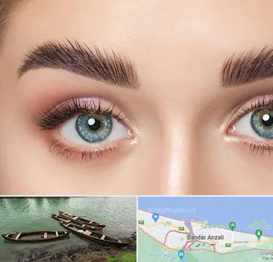 لیفت ابرو در بندر انزلی