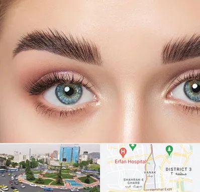 لیفت ابرو در ونک 