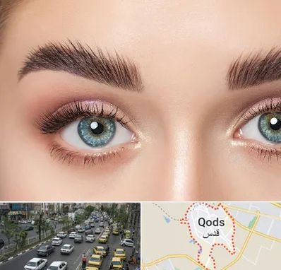 لیفت ابرو در شهر قدس