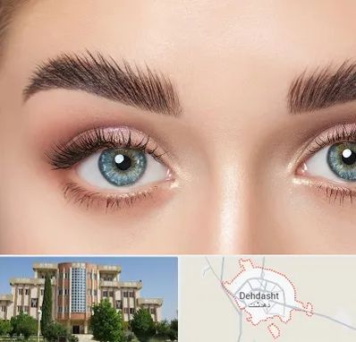 لیفت ابرو در دهدشت