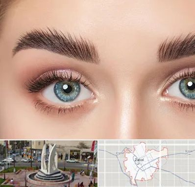 لیفت ابرو در زابل