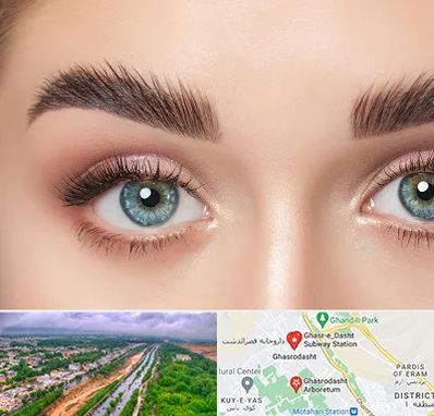 لیفت ابرو در قصرالدشت شیراز