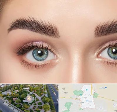 لیفت ابرو در کاشمر