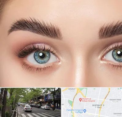 لیفت ابرو در ظفر 