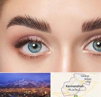 لیفت ابرو در کرمانشاه