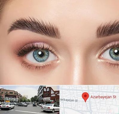 لیفت ابرو در خیابان آذربایجان