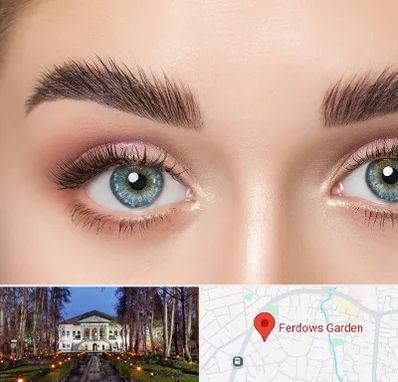 لیفت ابرو در باغ فردوس