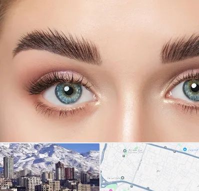 لیفت ابرو در ازگل