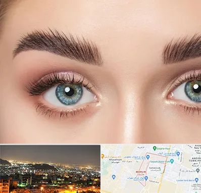 لیفت ابرو در مارلیک کرج