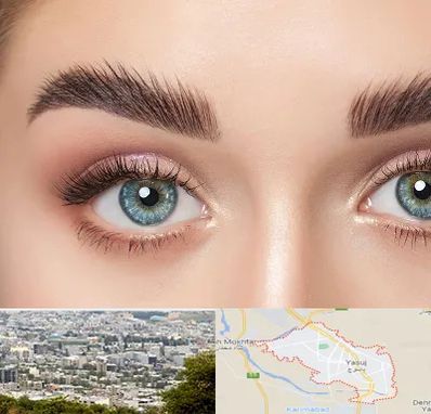 لیفت ابرو در یاسوج