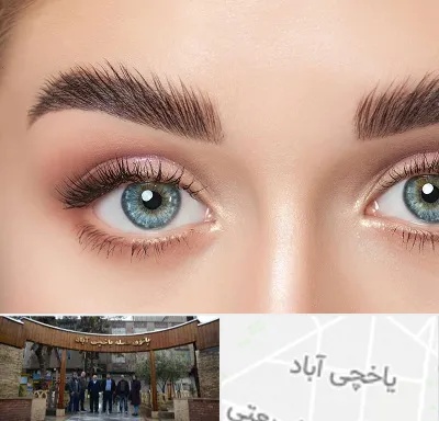 لیفت ابرو در یاخچی آباد