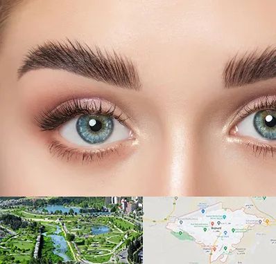 لیفت ابرو در بجنورد