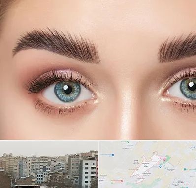 لیفت ابرو در محمد شهر کرج