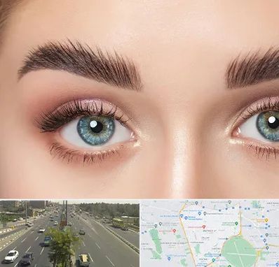 لیفت ابرو در منطقه 17 تهران