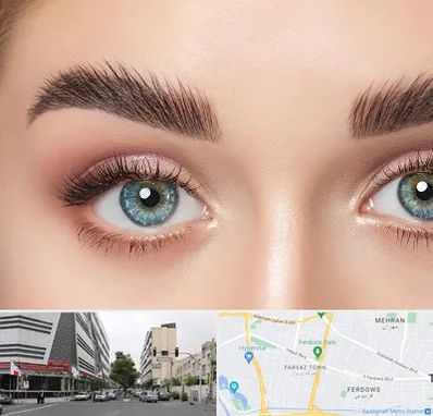 لیفت ابرو در بلوار فردوس 