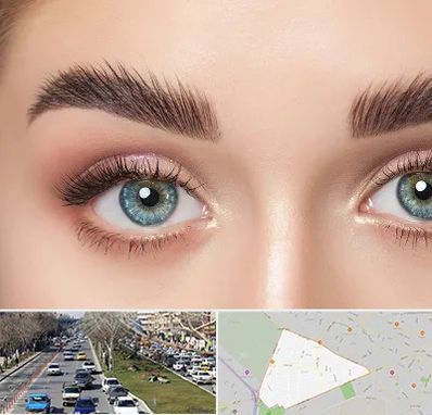 لیفت ابرو در احمدآباد مشهد