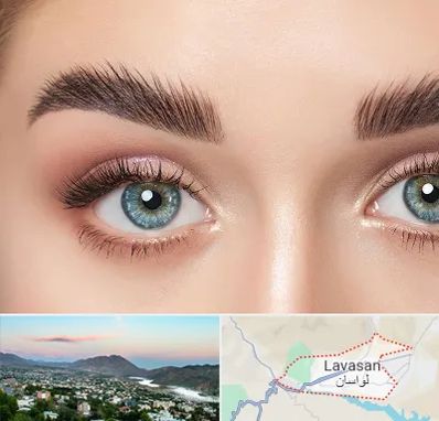 لیفت ابرو در لواسان