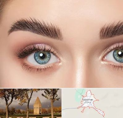 لیفت ابرو در تویسرکان