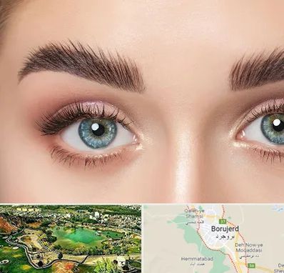 لیفت ابرو در بروجرد