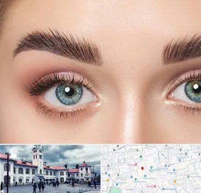 لیفت ابرو در میدان شهرداری رشت