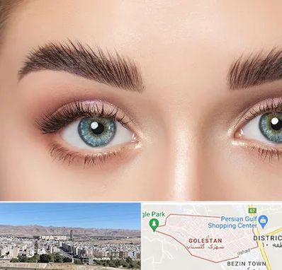 لیفت ابرو در شهرک گلستان شیراز